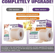 Silicone Scar Sheets