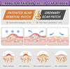 Silicone Scar Sheets