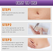 Silicone Scar Sheets