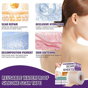 Silicone Scar Sheets