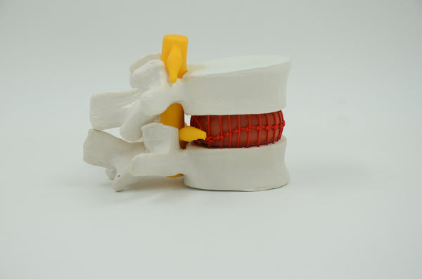 LUMBAR VERTEBRA WITH HEMOCYTE