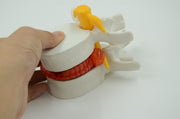 LUMBAR VERTEBRA WITH HEMOCYTE