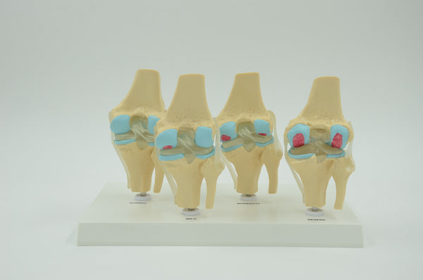 4-STAGE VERTEBRAE MODEL