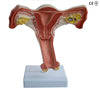 FEMALE INTERNAL GENITAL ORGAN MODEL